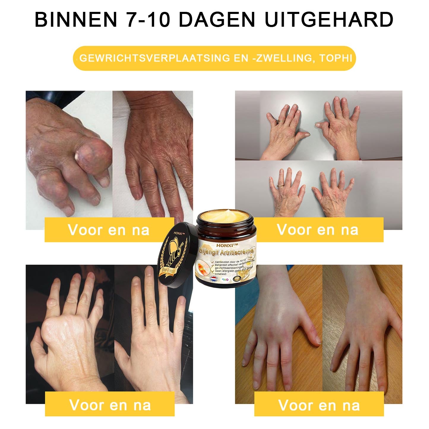 HONXI™ Bijengif Artritiscrème(Ontworpen voor senioren, adviseert NVO)