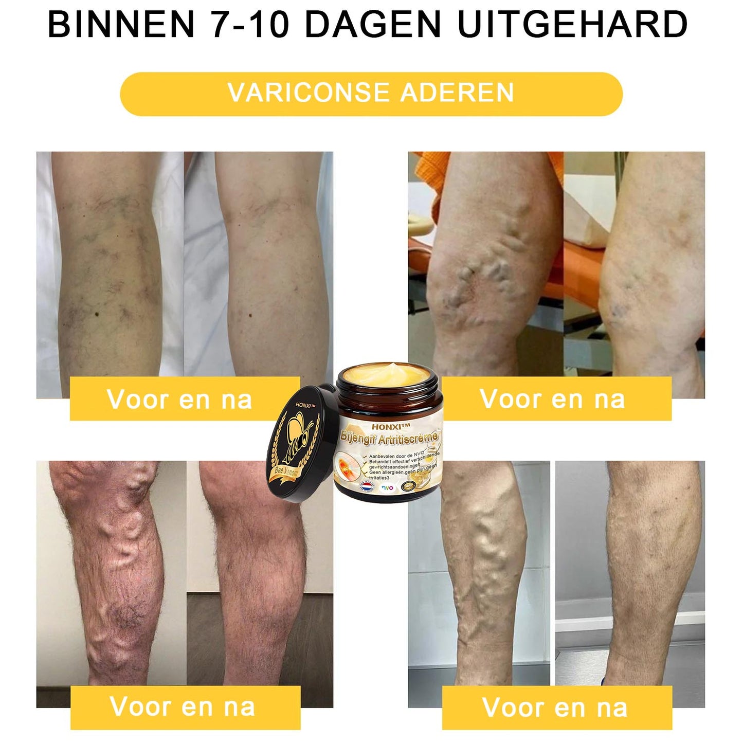 HONXI™ Bijengif Artritiscrème(Ontworpen voor senioren, adviseert NVO)