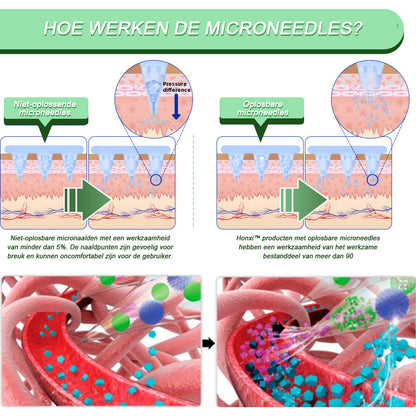 Honxi™ SMGT-GLP-1 Nano Microneedle Patch (Pijnloos, langdurig effect, gericht op diabetes, obesitas en cardiovasculaire aandoeningen)