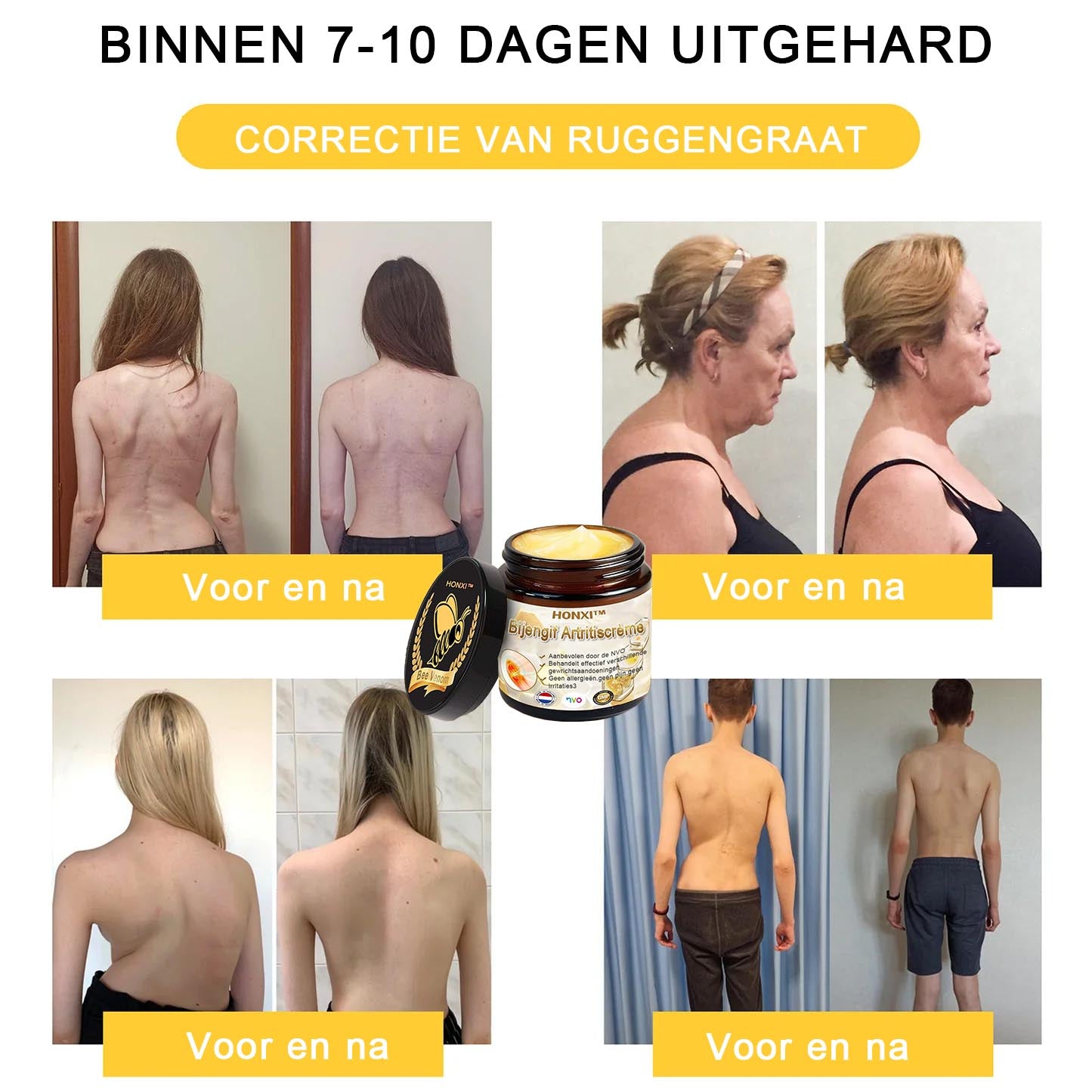 HONXI™ Bijengif Artritiscrème(Ontworpen voor senioren, adviseert NVO)
