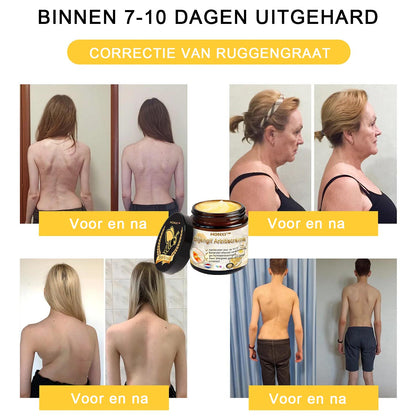 HONXI™ Bijengif Artritiscrème(Ontworpen voor senioren, adviseert NVO)