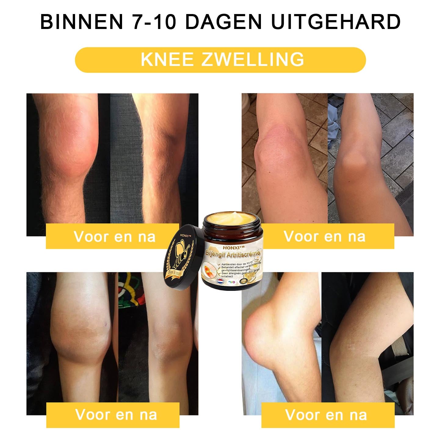 HONXI™ Bijengif Artritiscrème(Ontworpen voor senioren, adviseert NVO)