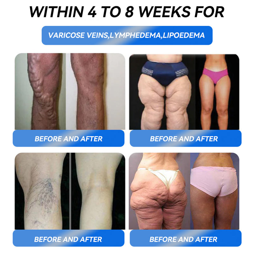 Honxi® GLP-1 Max Afslankoplossing ✅ 1 dosis per dag — merkbaar resultaat binnen 7 dagen!