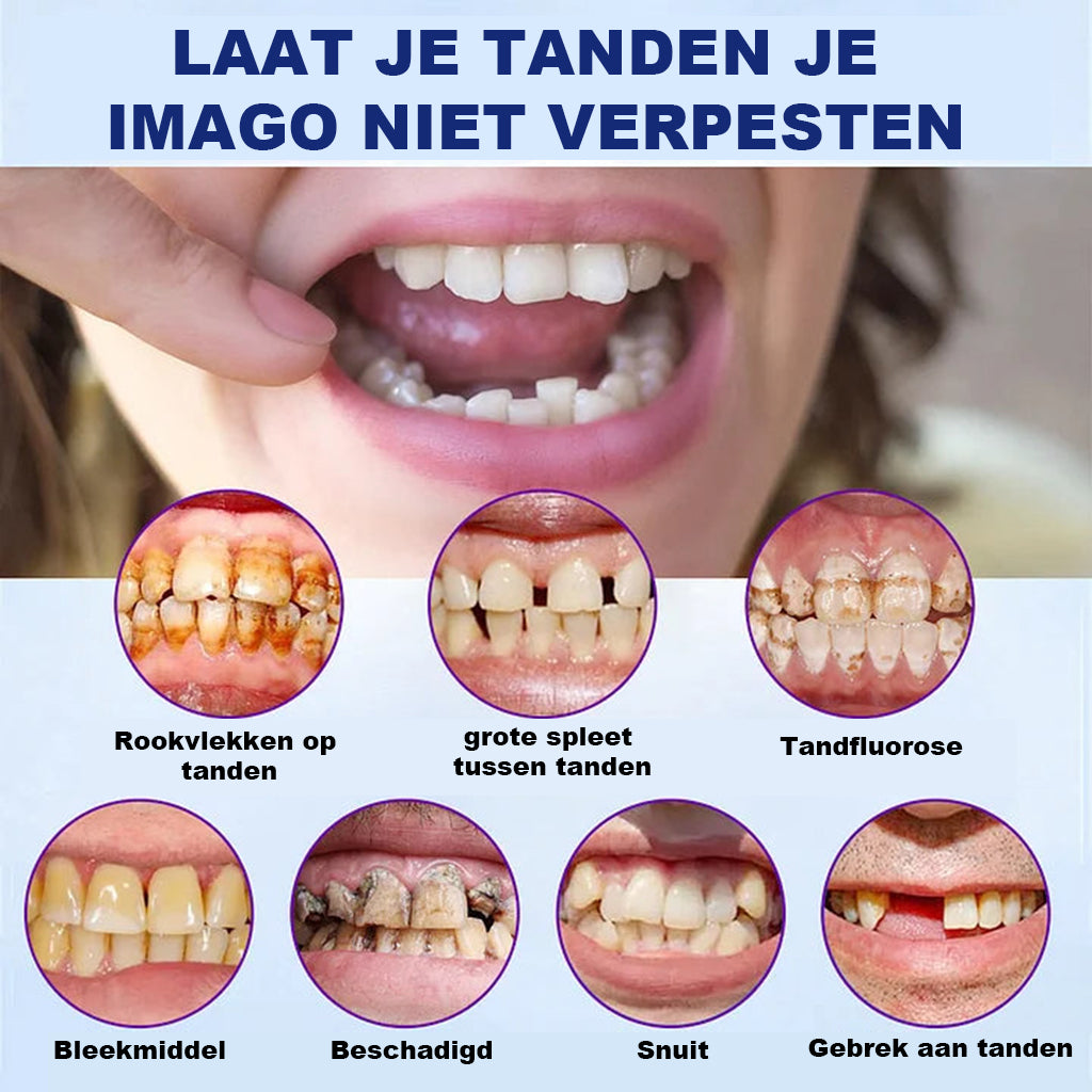 🔬Hermsa® - 🦷Geavanceerde, op maat gemaakte dagprotheseset🦷 (⏰Korting voor beperkte tijd in de laatste 30 minuten⏰)
