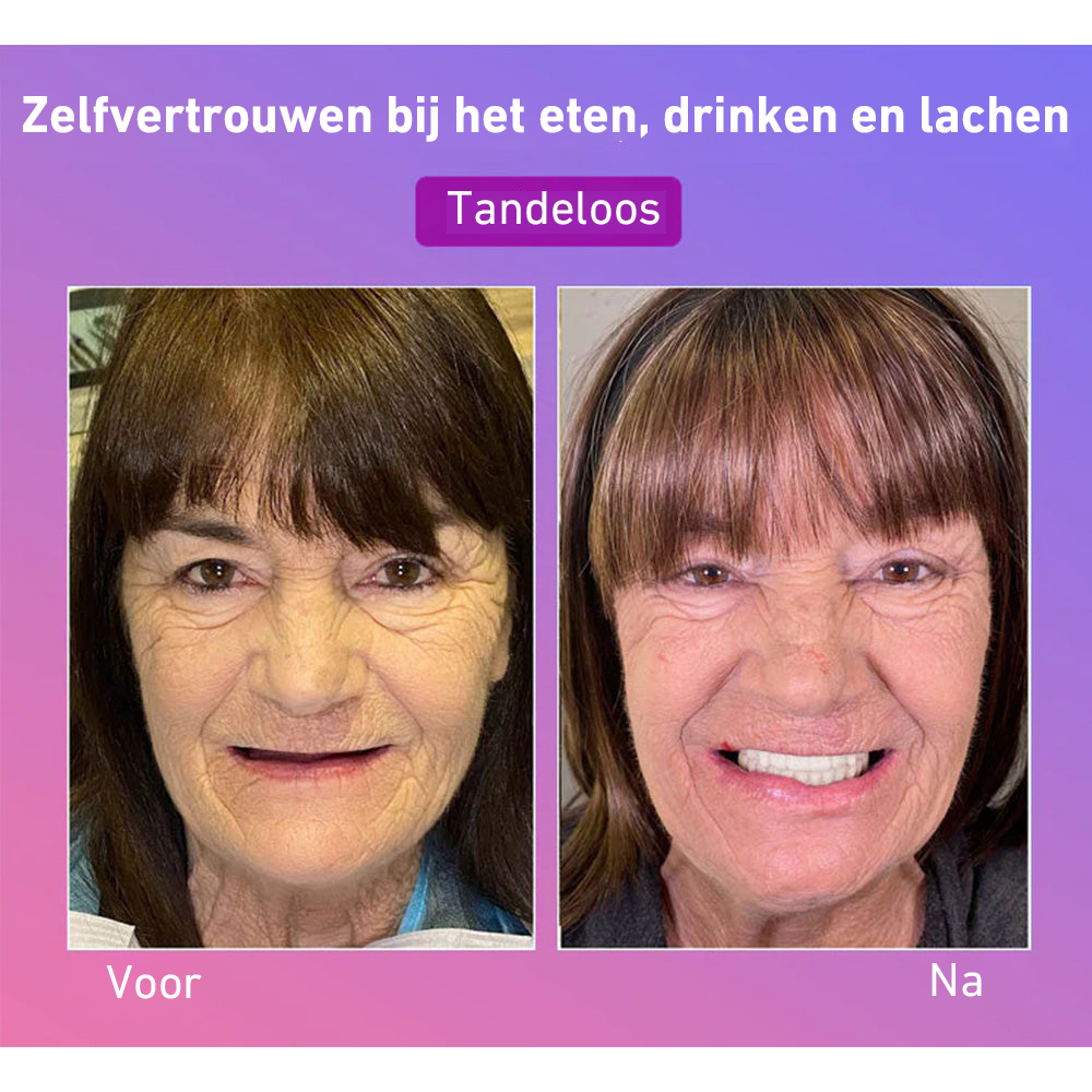 🦷Hermsa® Comfortabele kunstgebittenvan de volgende generatie🏆 (hoogwaardige kunstgebitten, gemakkelijk te dragen - beperkte korting van 70%)