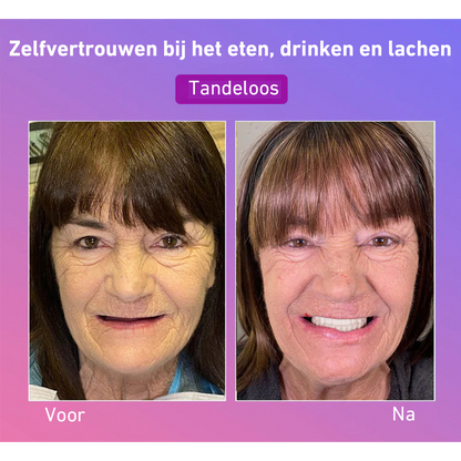 🦷Hermsa® Comfortabele kunstgebittenvan de volgende generatie🏆 (hoogwaardige kunstgebitten, gemakkelijk te dragen - beperkte korting van 70%)