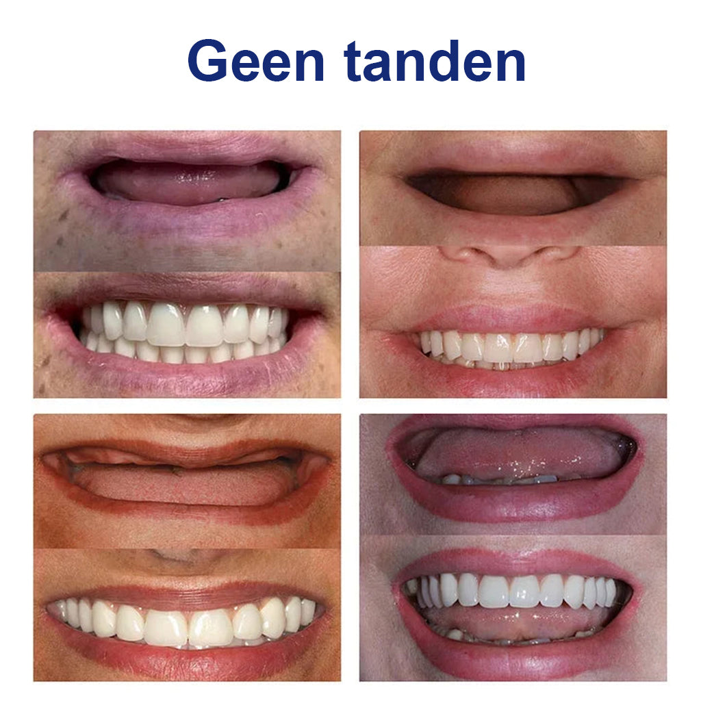 🔬Hermsa® - 🦷Geavanceerde, op maat gemaakte dagprotheseset🦷 (⏰Korting voor beperkte tijd in de laatste 30 minuten⏰)