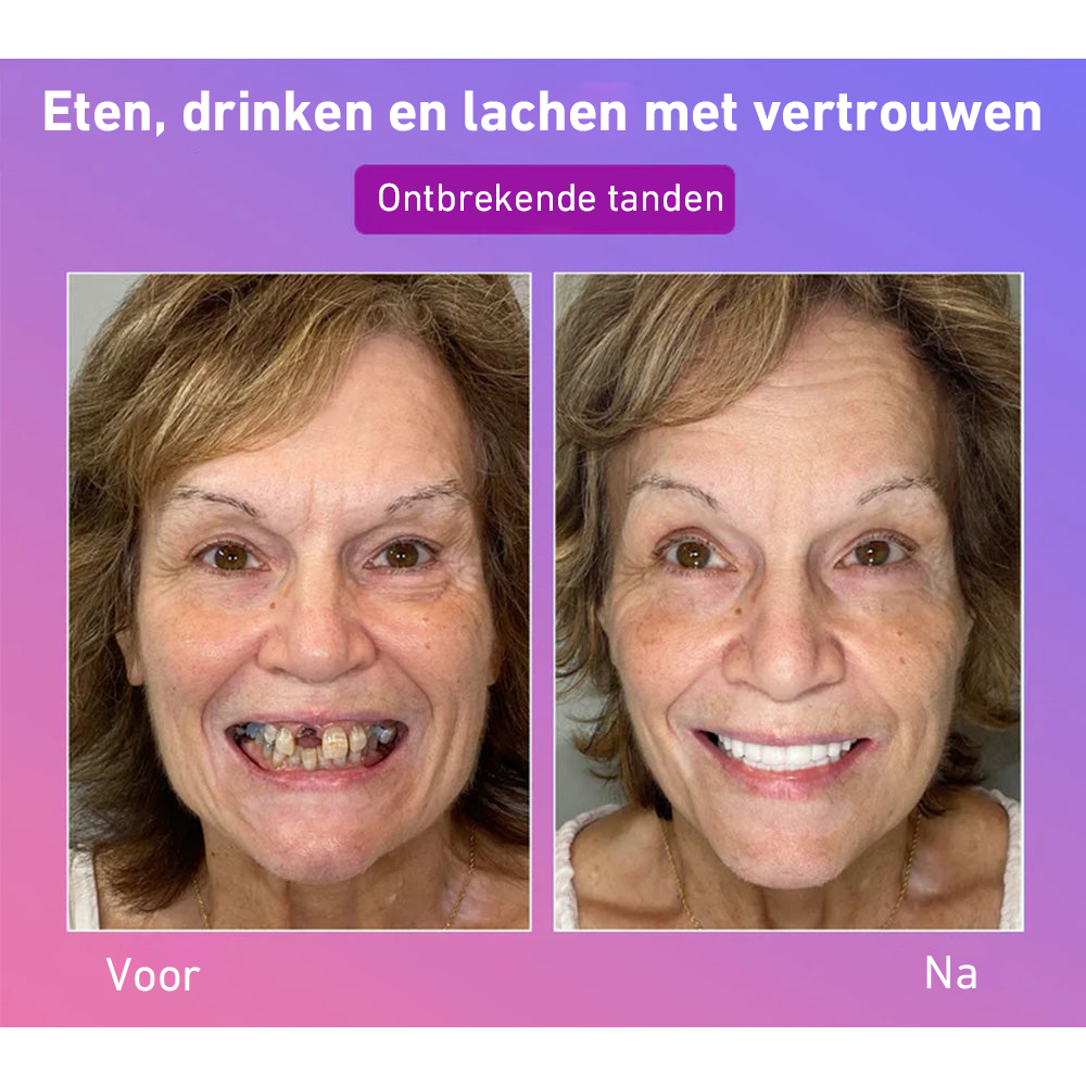 🦷Hermsa® Comfortabele kunstgebittenvan de volgende generatie🏆 (hoogwaardige kunstgebitten, gemakkelijk te dragen - beperkte korting van 70%)