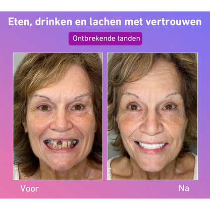 🦷Hermsa® Comfortabele kunstgebittenvan de volgende generatie🏆 (hoogwaardige kunstgebitten, gemakkelijk te dragen - beperkte korting van 70%)