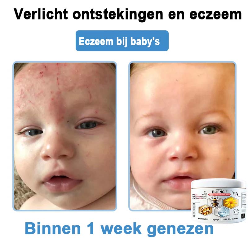Raindew™ Bijengif Multisymptoom Behandelingscrème (👨‍⚕ Aanbevolen door de Nederlandse Vereniging voor Dermatologie)