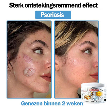 Raindew™ Bijengif Multisymptoom Behandelingscrème (👨‍⚕ Aanbevolen door de Nederlandse Vereniging voor Dermatologie)