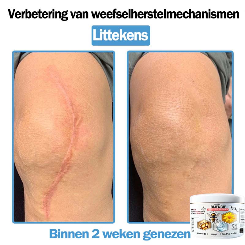 Raindew™ Bijengif Multisymptoom Behandelingscrème (👨‍⚕ Aanbevolen door de Nederlandse Vereniging voor Dermatologie)