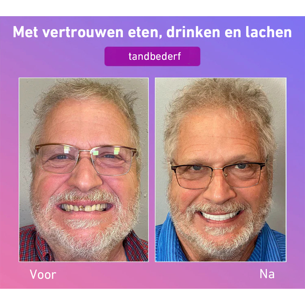 🦷Hermsa® Comfortabele kunstgebittenvan de volgende generatie🏆 (hoogwaardige kunstgebitten, gemakkelijk te dragen - beperkte korting van 70%)
