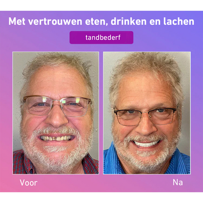 🦷Hermsa® Comfortabele kunstgebittenvan de volgende generatie🏆 (hoogwaardige kunstgebitten, gemakkelijk te dragen - beperkte korting van 70%)
