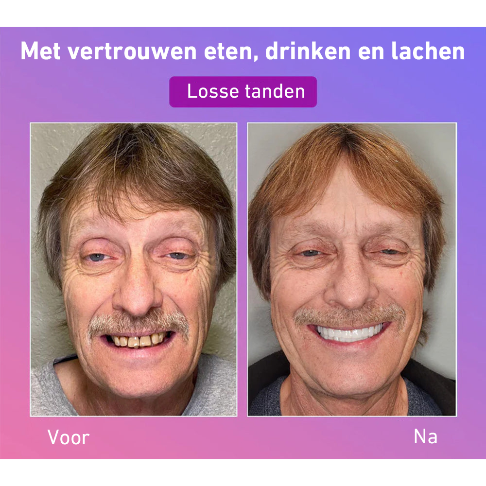 🦷Hermsa® Comfortabele kunstgebittenvan de volgende generatie🏆 (hoogwaardige kunstgebitten, gemakkelijk te dragen - beperkte korting van 70%)