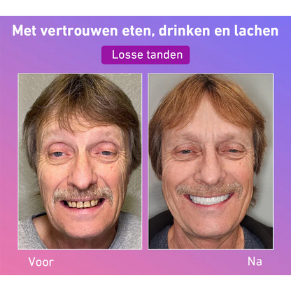 🦷Hermsa® Comfortabele kunstgebittenvan de volgende generatie🏆 (hoogwaardige kunstgebitten, gemakkelijk te dragen - beperkte korting van 70%)