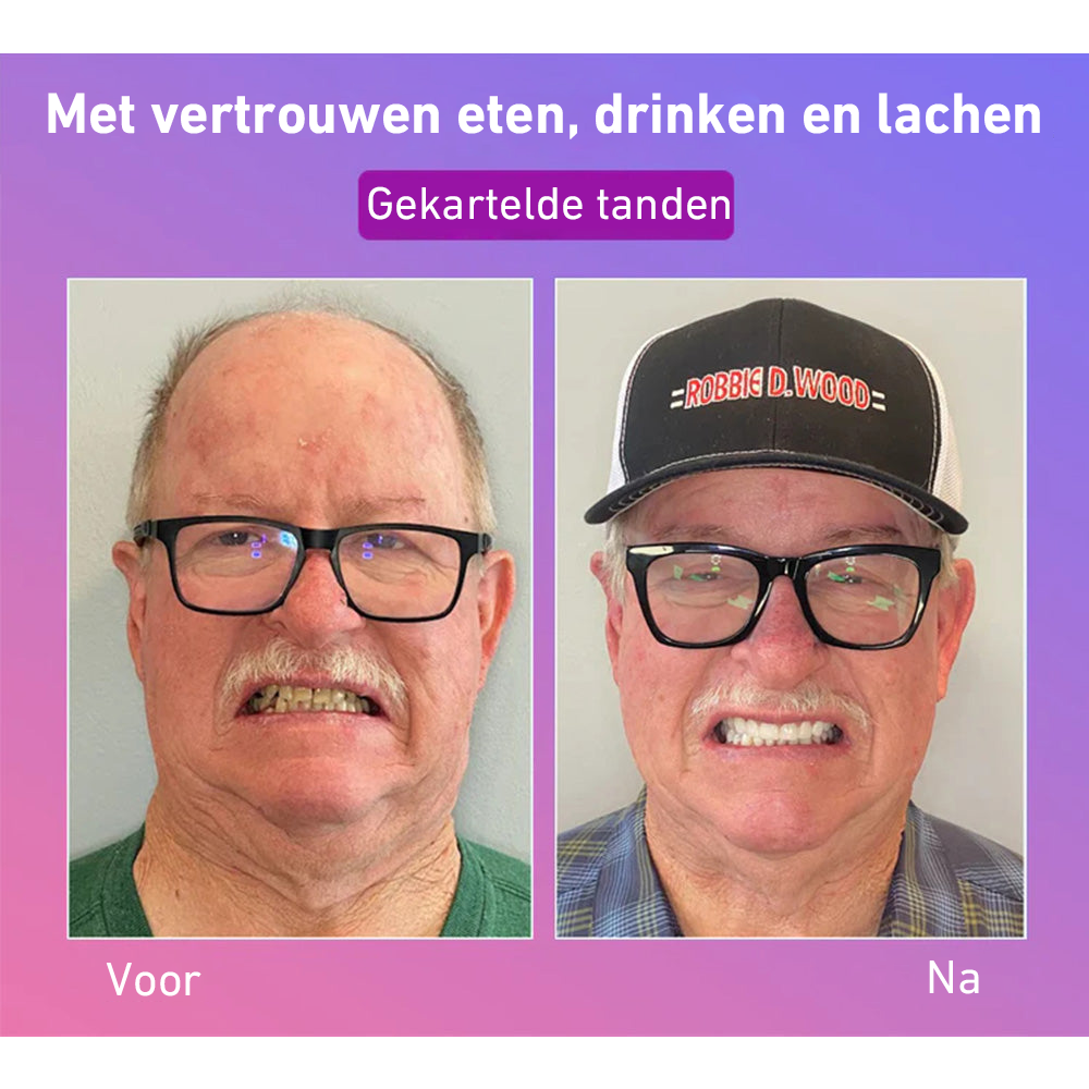 🦷Hermsa® Comfortabele kunstgebittenvan de volgende generatie🏆 (hoogwaardige kunstgebitten, gemakkelijk te dragen - beperkte korting van 70%)