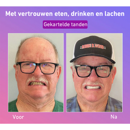 🦷Hermsa® Comfortabele kunstgebittenvan de volgende generatie🏆 (hoogwaardige kunstgebitten, gemakkelijk te dragen - beperkte korting van 70%)