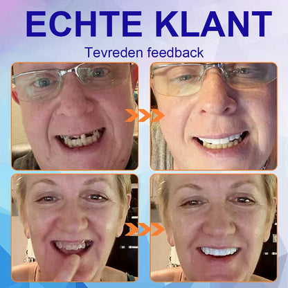 🔬Hermsa® - 🦷Geavanceerde, op maat gemaakte dagprotheseset🦷 (⏰Korting voor beperkte tijd in de laatste 30 minuten⏰)